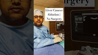 Liver Cancer Cure by Ablation: No Surgery !!    #shorts #ytshorts #youtubeshorts #Doctorinkerala