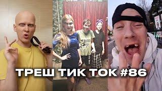 О НЕТ, ФИМОЗ / ТРЕШ ТИК ТОК #86
