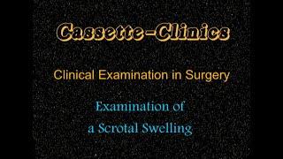 CS03_ Examination of Scrotal Swelling. Video Film by Dr. Ghanashyam Vaidya