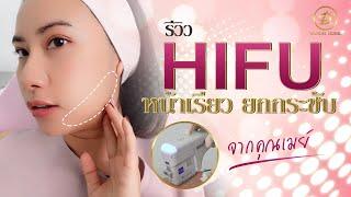รีวิวไฮฟู Hifu หน้าเรียวกระชับ จากคุณเมย์ ไฮฟู่ที่ไหนดี Hifu