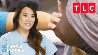 Biggest Pimples on Unmentionables | Dr. Pimple Popper | TLC