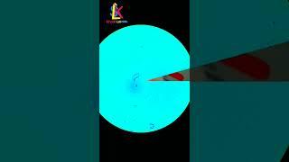 urine sample under microscope.