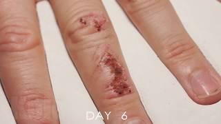 Wound Healing Time Lapse