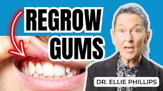 How to REGROW Receding Gums at Home