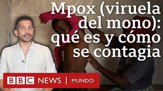 Mpox: qué es y cómo se contagia la enfermedad por la que la OMS declaró emergencia internacional