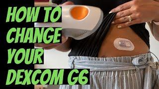 How to Change Your Dexcom G6 CGM - Easy to follow guide