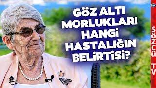 Göz Altı Morlukları Neden Olur? Canan Karatay 'Çok Büyük Belirti' Diyerek Anlattı