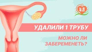  Удалили 1 трубу - можно ли забеременеть?