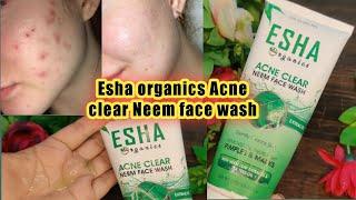 Esha organics reviews | esha organics face wash review | Neem face wash | su beauty and remedies 