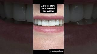 Сложный выбор: Виниры переделывать или оставить? #стоматология