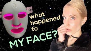 I Tried an LED Mask | Acne-Prone Skin (Qure Skincare)