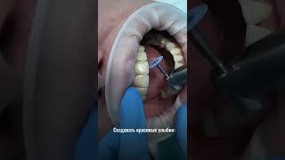 Доктор Кокуйская #композитныевиниры #лечениезубов #юмор #smile