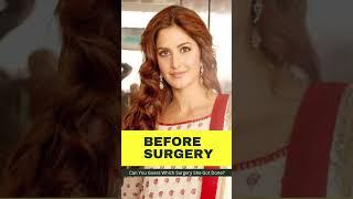 Katrina Kaif: Can You Guess Which Surgery She Got Done? | Bollywood News | Her Zindagi #shorts