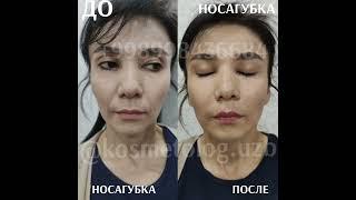 BEAUTICIAN AZIZA|KOSMETOLOG AZIZA|KOSMETOLOG|BEAUTICIAN|COSMETOLOGY AZIZA|КОСМЕТОЛОГ АЗИЗА| #fyp