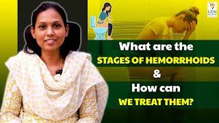 Understanding the medical procedures of Hemorrhoids | GEM Hospitals