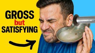 Gentle Ear Wax Removal | Best Earcare by specialists #earwaxremoval #earwaxremoving #earcleaning