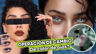 MI OPERACIÓN DE CAMBIO DE COLOR DE OJOS? TU LO HARÍAS?