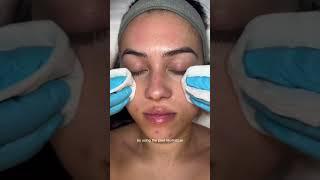 Facial Peel