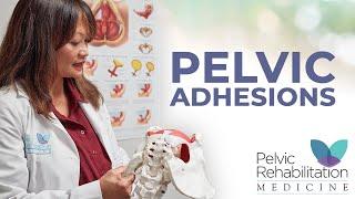 Pelvic Adhesions | Dr. Allyson Shrikhande | Pelvic Rehabilitation Medicine