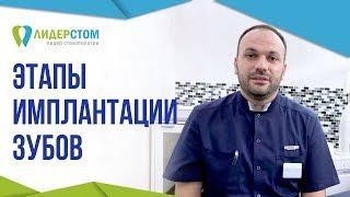 Этапы имплантации зубов.  Операция по установке импланта за один день.