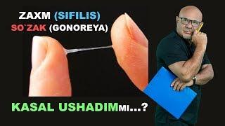 #155 FOXISHADAN KASAL USHADIMmi...? ZAXM, SO'ZAK