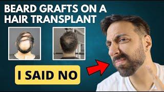 6 Reasons I Didn't Use Beard Hair for My Hair Transplant