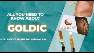 All New GOLDIC  for Late Stage Osteoarthritis: All you need to know