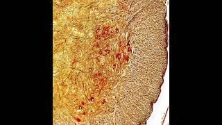 Histology of spinal cord staining Silver nitrate :special figure