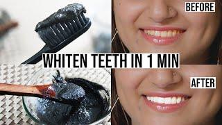 DIY Natural Toothpaste To Whiten Teeth at Home in 1 Minute | Bentonite Clay Teeth Whitening