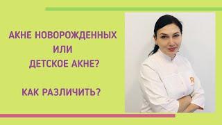 Детское акне или акне новорожденных?