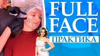 Full face практика. Контурная пластика филлерами на основе гиалуроновой кислоты.