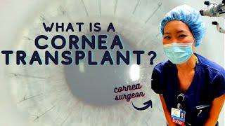 Cornea Surgeon Explains... What is a Cornea Transplant? | Top 3 Reasons For Cornea Surgery!