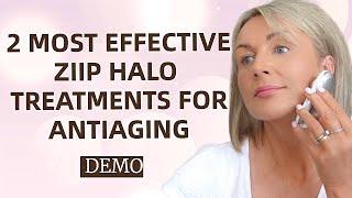 Two Best And Most Effective Anti Aging Treatments With ZIIP Halo - DEMO