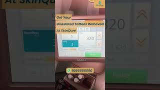 Get your unwanted Tattoo removed at @skinqure | Delhi | #shorts