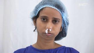 Unbelievable Face Change in Just 30 Days | Real Surgical Results