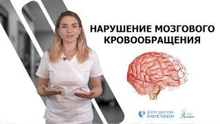 Нарушение мозгового кровообращения с точки зрения миотерапии