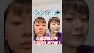 【醫美幫你試，變美不踩雷！】#三倍光 神奇之光敏感、泛紅、毛孔都明顯改善了~~妝也更貼了️️