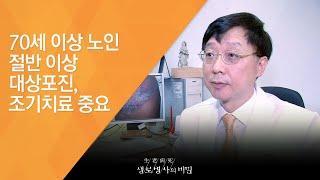 70세 이상 노인 절반 이상 대상포진, 조기치료 중요 - (2014.7.23_510회 방송)_빨라야 산다! 통증의 왕, 대상포진