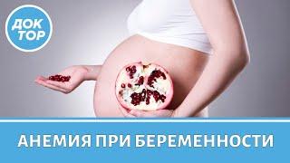 Анемия у беременных: симптомы, причины, анализы, лечение