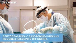 Септопластика с вазотомией нижних носовых раковин в ОН КЛИНИК.