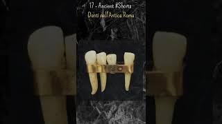 17 - Ancient #Shorts: Denti nell'Antica Roma