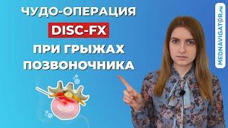 DISC-FX при грыжах позвоночника 3 в 1: нуклеотомия, нуклеопластика, аннулопластика | Mednavigator.ru