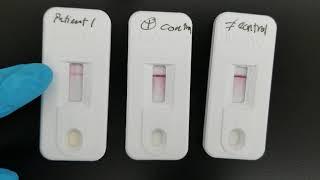 Immunology: Infectious Mononucleosis Test