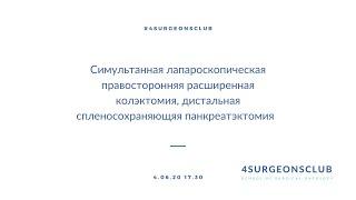 Лапароскопическая правосторонняя колэктомия, дистальная спленосохраняющая панкреатэктомия