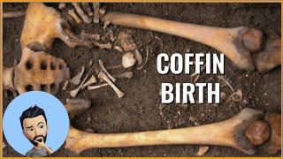 The rare cases of “Coffin Birth”.