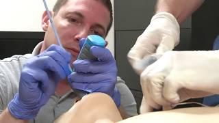Vie Scope® on the News: Securing a Difficult Airway