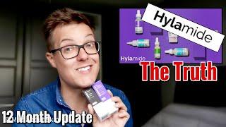 HYLAMIDE REVIEW - 1 Year Update Using Hylamide By Deciem | Holy Grail or Skincare Fail