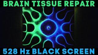 Brain Repair, Cell Regeneration, Reduce Anxiety, Black Screen, 528Hz, Deep Sleep, Meditation Music