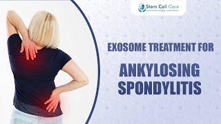 Ankylosing Spondylitis Treatment: How Exosomes and Stem Cells Can Help |