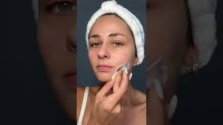 How to Banish Hyperpigmentation: SkinMedica Even & Correct Review | Exclusive Beauty Club